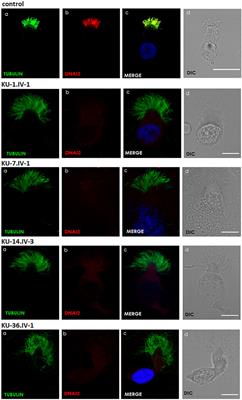 Identification of a novel founder variant in DNAI2 cause primary ciliary dyskinesia in five consanguineous families derived from a single tribe descendant of Arabian Peninsula